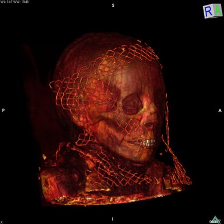 scanner-momies-elephantine-assouan-haute-egypte